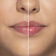 LIP INJECTION 1.5GR